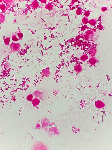 ecoli_cbccom2